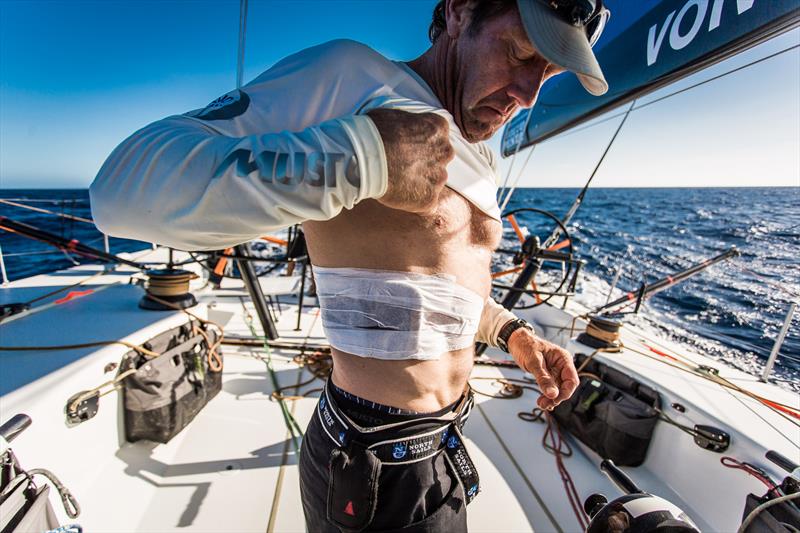 Tony Rae injures a rib during Leg 1 of the Volvo Ocean Race photo copyright Brian Carlin / Team Vestas Wind / Volvo Ocean Race taken at  and featuring the Volvo One-Design class