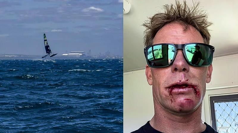 Chris Draper - with stitches - SailGP Fremantle  - January 2026 - photo © SailGP